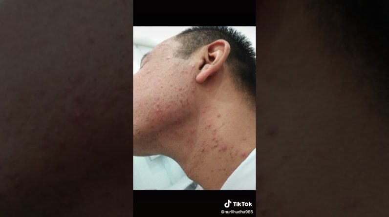 1766015364 maxresdefault