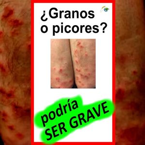 1766018996 maxresdefault