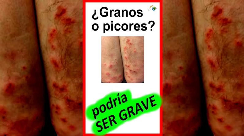 1766018996 maxresdefault