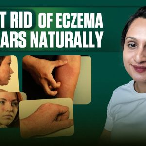 1766019229 maxresdefault