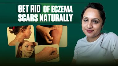 1766019229 maxresdefault