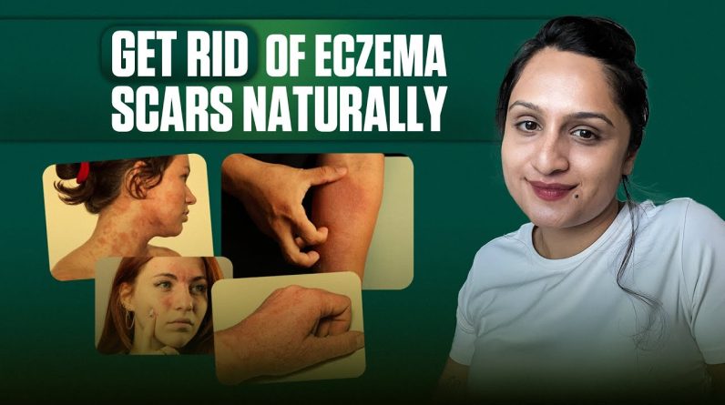 1766019229 maxresdefault