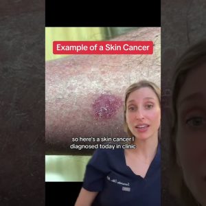 1766020292 maxresdefault