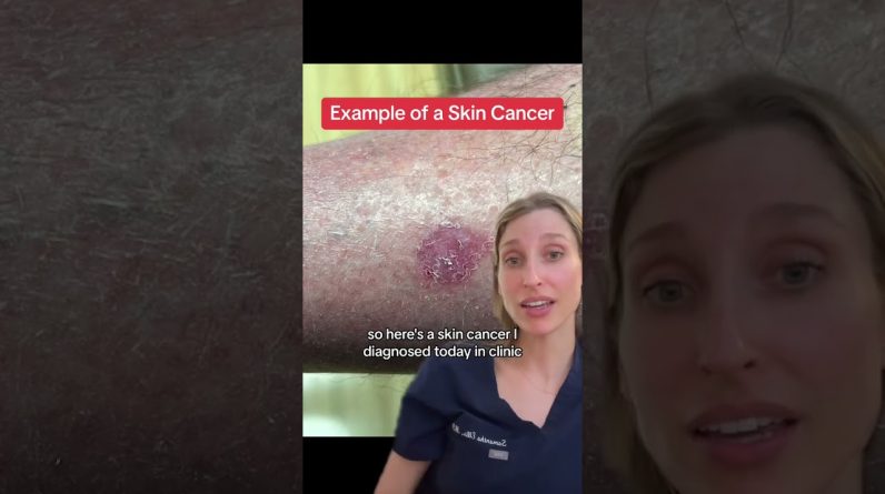 1766020292 maxresdefault