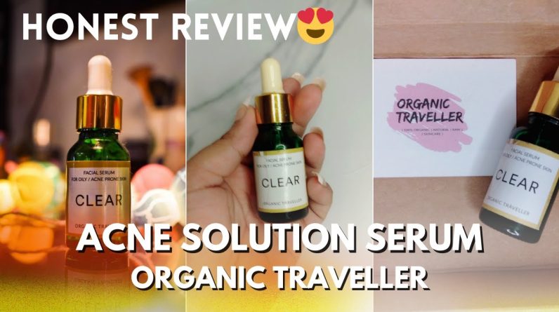 1766026397 maxresdefault