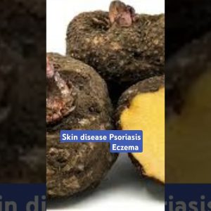 1766030405 maxresdefault