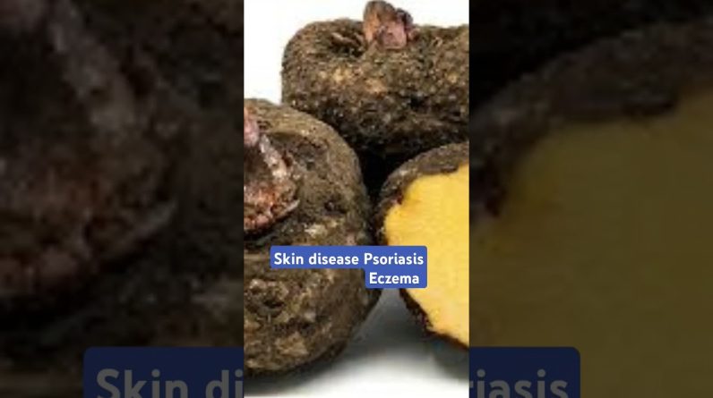 1766030405 maxresdefault