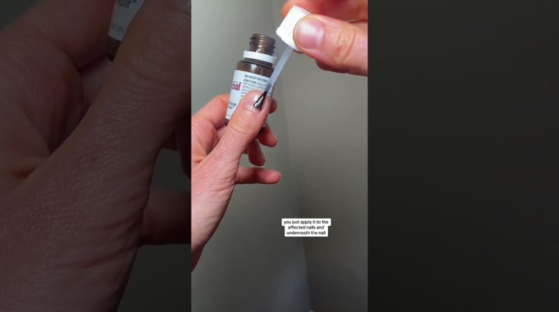 1766031251 maxresdefault