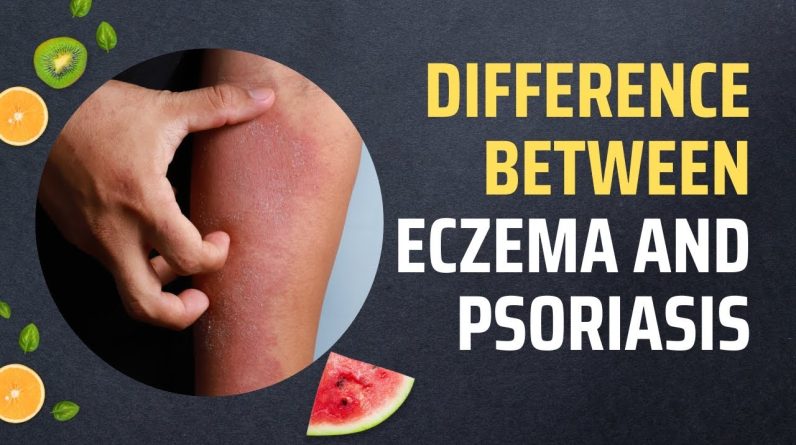 1766034086 maxresdefault