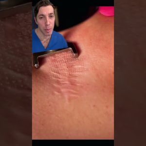 1766045889 maxresdefault