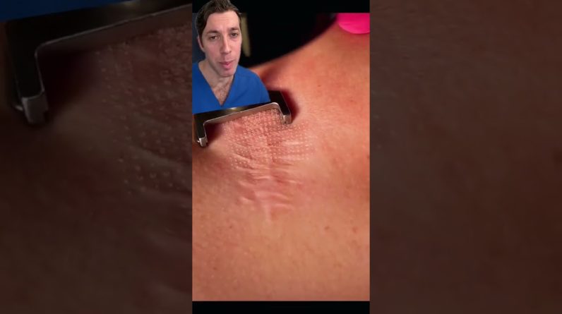 1766045889 maxresdefault