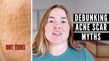 1766053328 maxresdefault