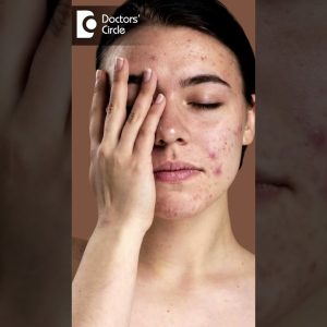 1766060503 maxresdefault