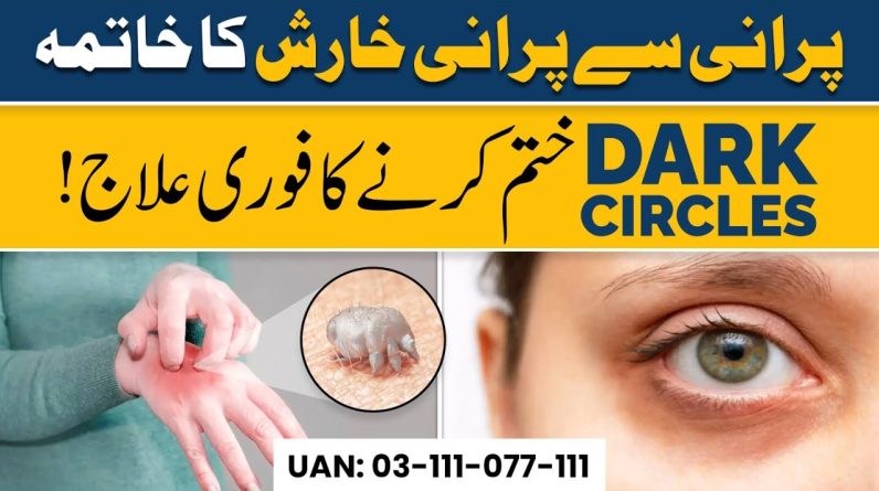 1766067943 maxresdefault