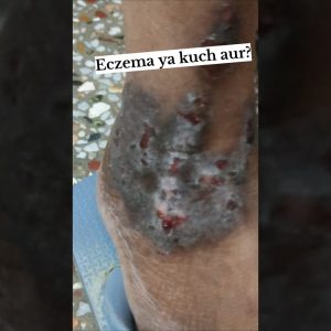 1766075344 maxresdefault