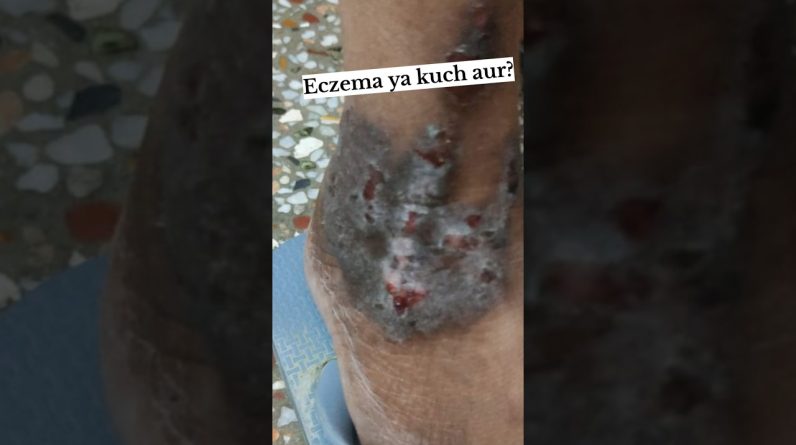 1766075344 maxresdefault