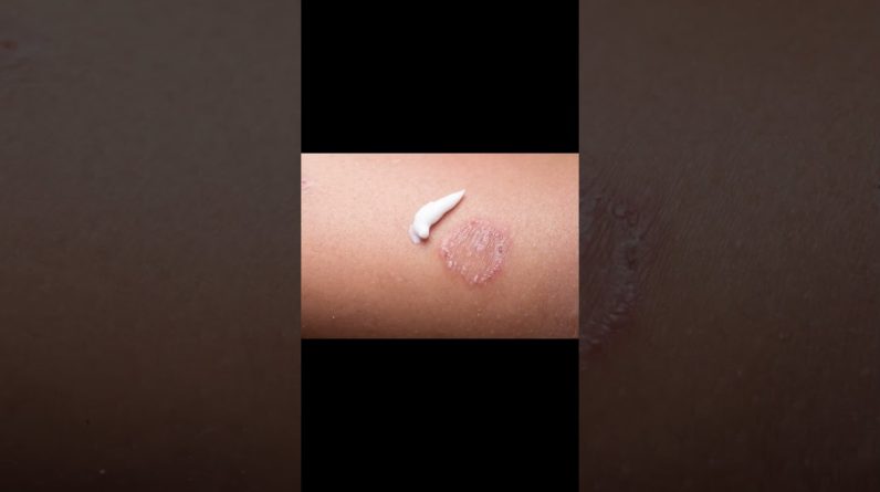 1766077858 maxresdefault