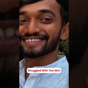 1766078100 maxresdefault