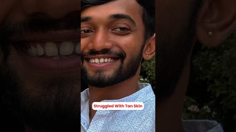 1766078100 maxresdefault