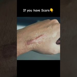 1766088881 maxresdefault