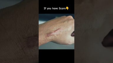 1766088881 maxresdefault