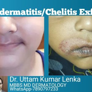 1766097215 maxresdefault