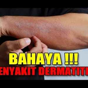 1766114524 hqdefault