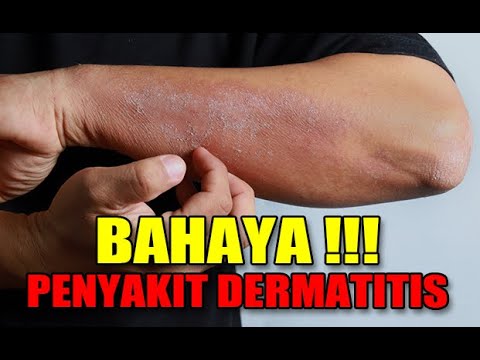 1766114524 hqdefault