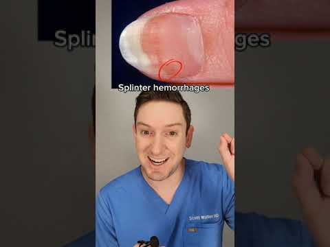 1766115505 hqdefault