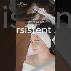 1766129154 maxresdefault