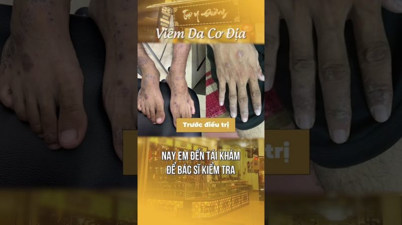 1766132814 maxresdefault