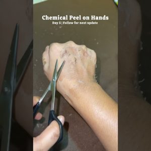 1766133927 maxresdefault