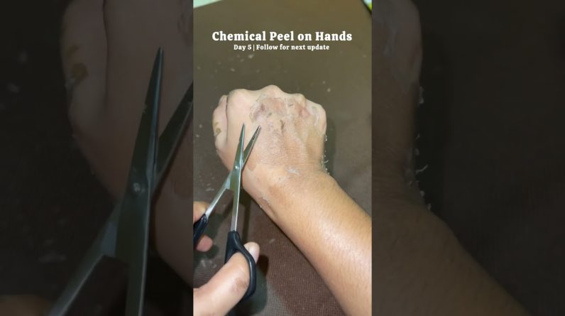 1766133927 maxresdefault