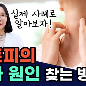 1766143868 maxresdefault