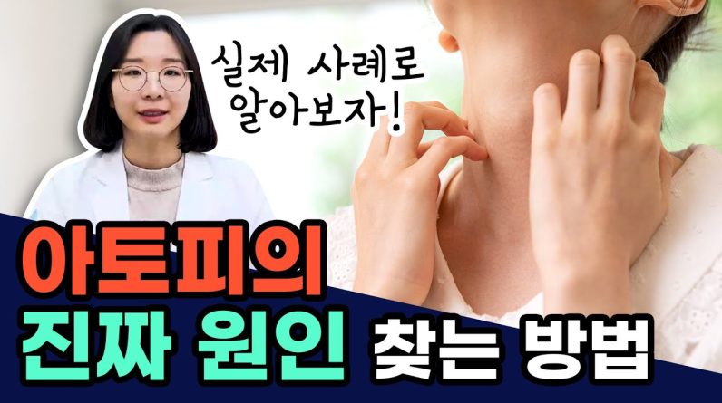 1766143868 maxresdefault