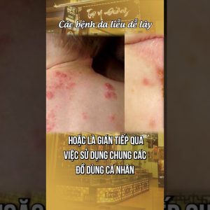 1766151129 maxresdefault