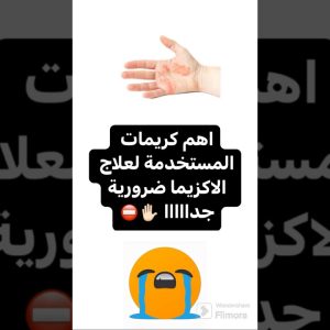 1766152875 maxresdefault