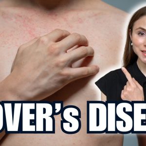 1766154875 maxresdefault