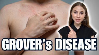 1766154875 maxresdefault