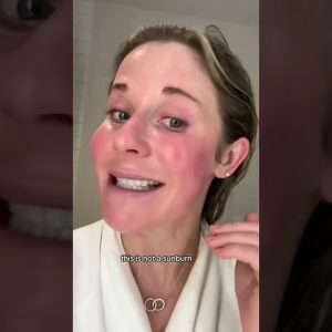 1766156132 maxresdefault