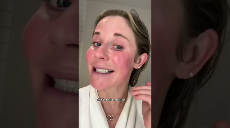 1766156132 maxresdefault