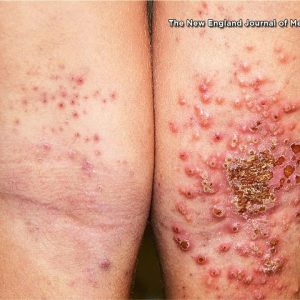 1766158639 maxresdefault