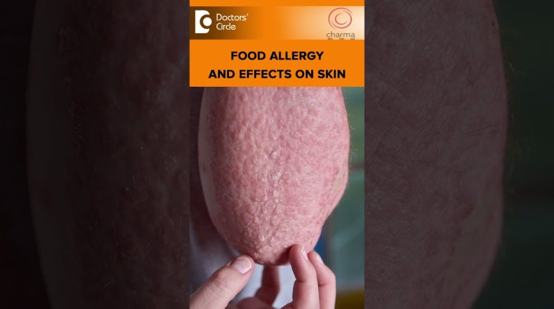 1766159581 maxresdefault