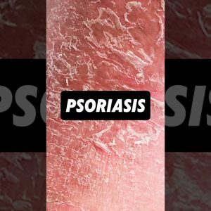 1766174474 maxresdefault