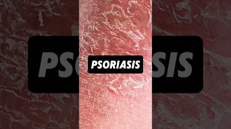 1766174474 maxresdefault