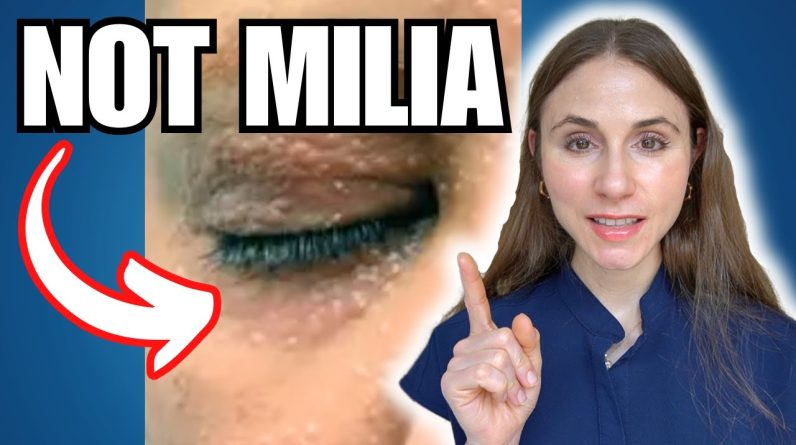 1766176755 maxresdefault