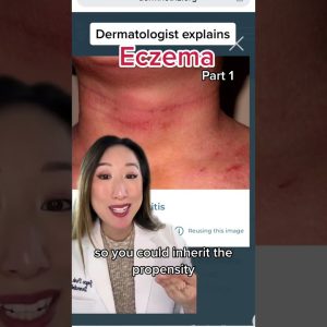 1766176900 maxresdefault