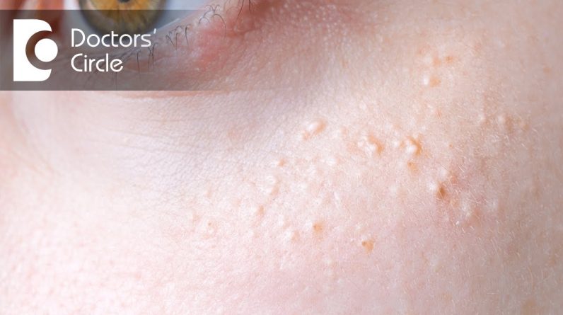 1766177834 maxresdefault