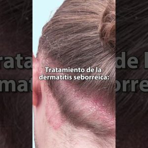 1766178130 maxresdefault