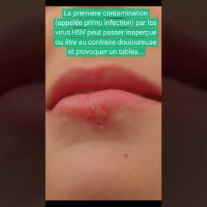 1766180397 hqdefault